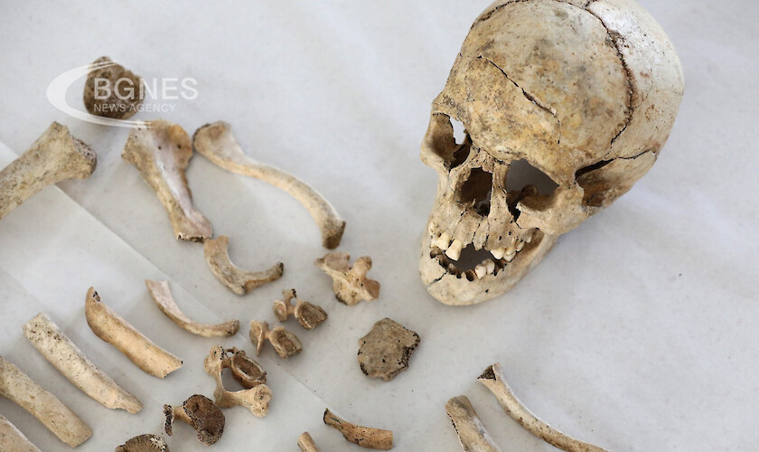 Археолози откриха два скелета със следи от елементарна мозъчна хирургия,